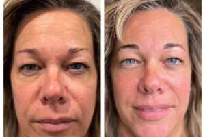 eybww_before_after_2