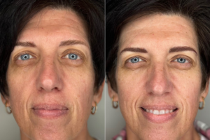 EYBWW_Gallery_2 EYBWW_Gallery_2