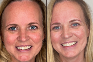 EYBWW_Gallery_4 EYBWW_Gallery_4