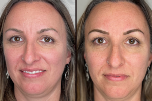 EYBWW_Gallery_5 EYBWW_Gallery_5