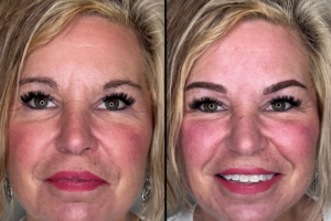 EYBWW_Gallery_6 EYBWW_Gallery_6